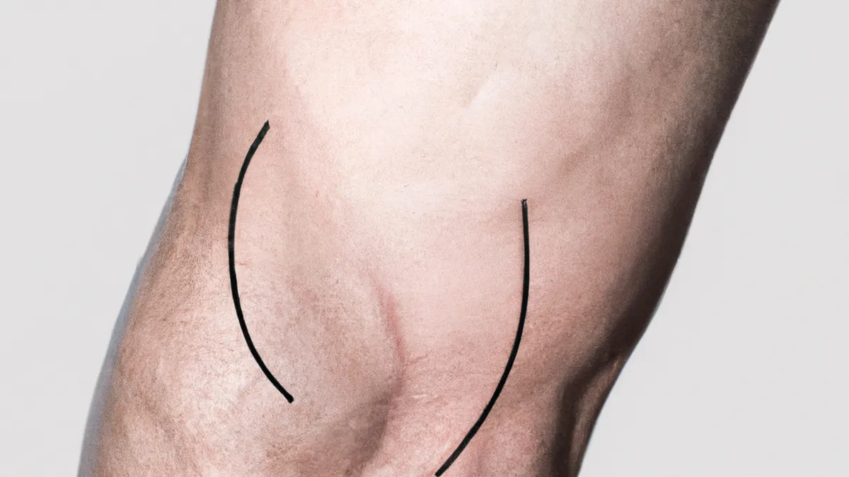 Are Your Quads Too Strong? Assessing Balance